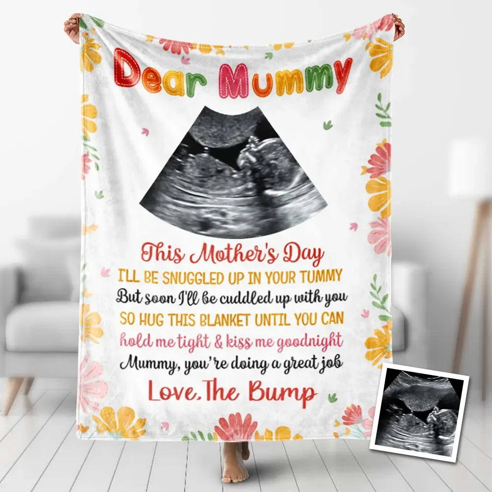 Custom Ultrasound Blankets Personalized Mother's Day Blanket